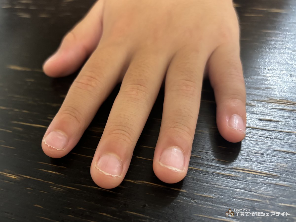 ヌルエールSを塗った6歳児の指先 爪がきれいに伸びている